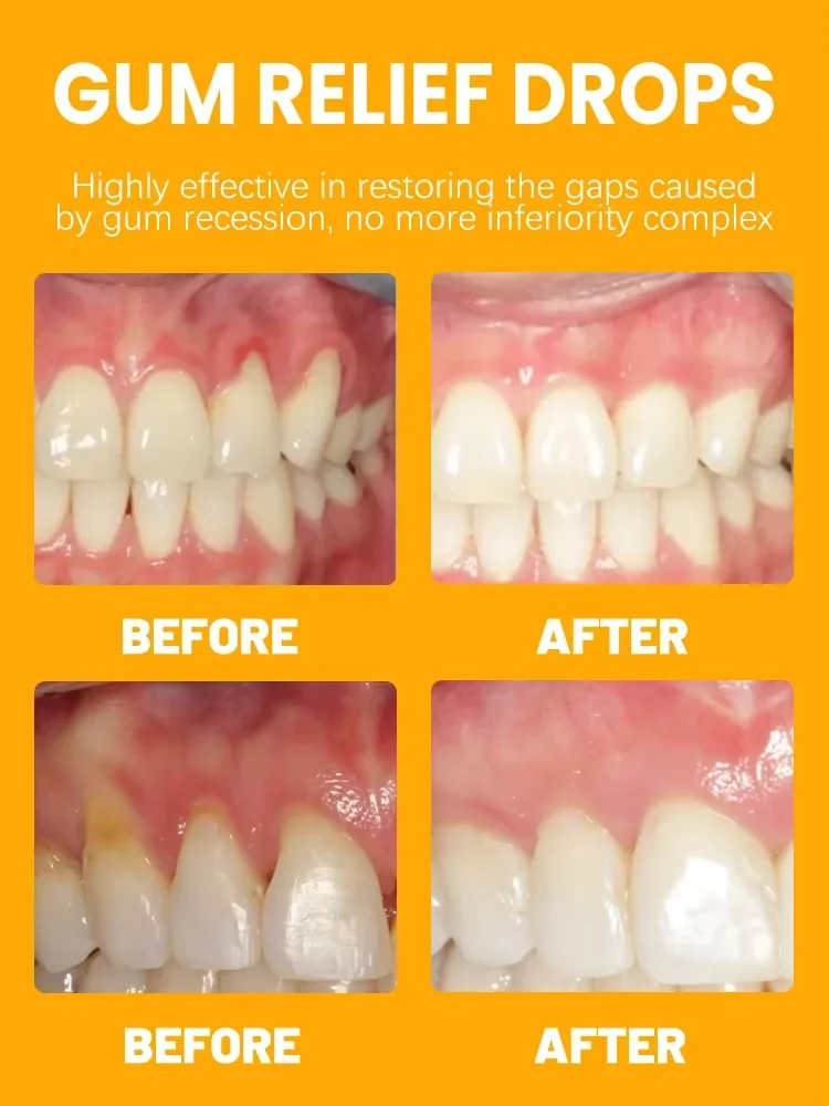 Rapid Repair Gums Serum Effectively Relieve Tooth Allergy Dental Caries Tooth Cleaning Toothpaste Relieve Tooth Damage Drops - Image 3