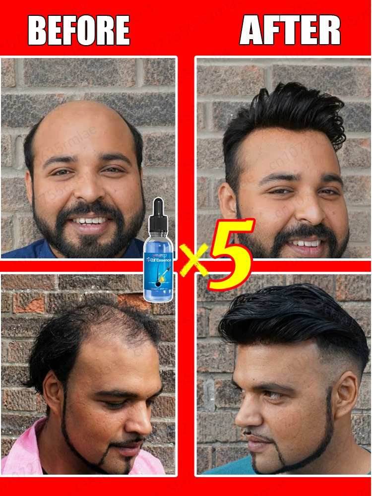 Hair growth essential oil, effectively repair baldness and hair loss, new hair growth - Image 2