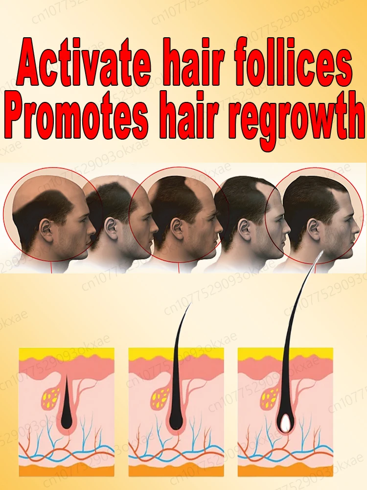 Hair growth essential oil, effectively repair baldness and hair loss, new hair growth - Image 6