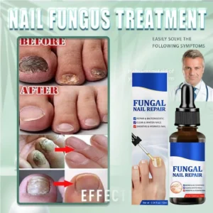 ʰᵉˡˡᵒ Fungal Nail Treatment Essence Oil Nail Fungus Laser Device Repair Toenail Fingernail Treatment Onychomycosis with Mushroom