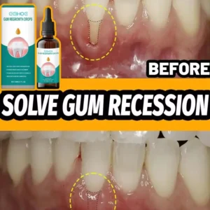 Rapid Repair Gums Serum Effectively Relieve Tooth Allergy Dental Caries Tooth Cleaning Toothpaste Relieve Tooth Damage Drops