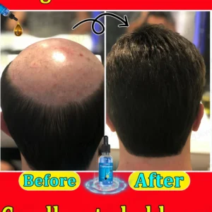 Hair growth essential oil, effectively repair baldness and hair loss, new hair growth